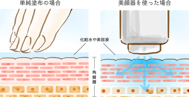 美容成分を浸透させるイオン導入美顔器