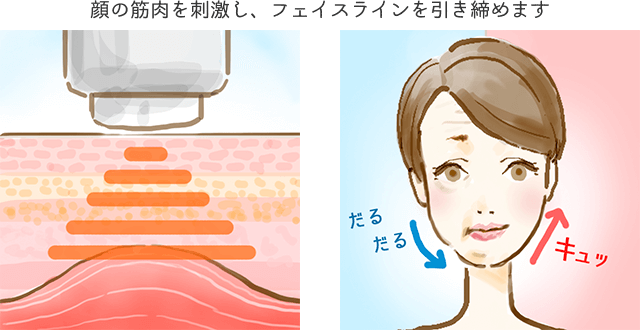 表情筋など顔の筋肉にアプローチし、刺激を与え筋肉を動かす