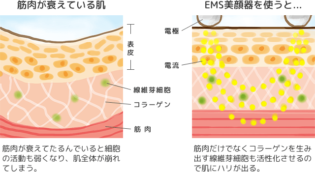 EMSの仕組みについて