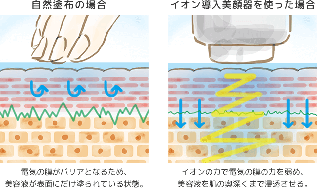 イオン導入の解図