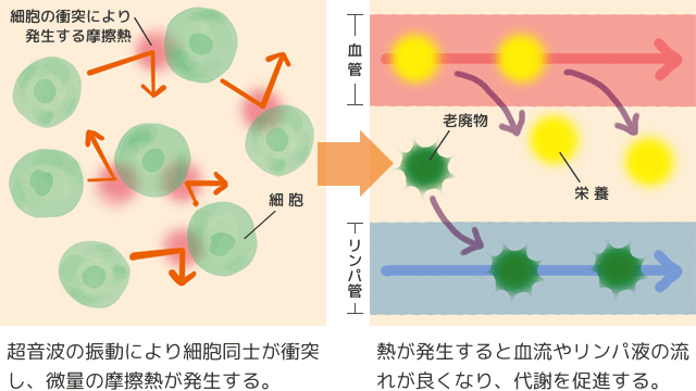 超音波美顔器の温熱効果の解図