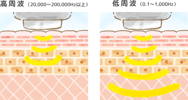 超音波美顔器の周波数での違い